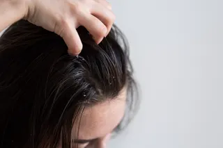 Rambut Gatal Bukan Sekadar Ketombe